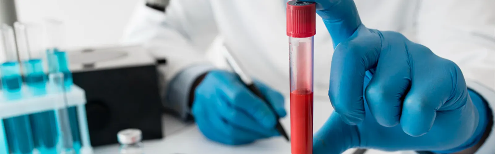 Best Blood Test Lab in Delhi